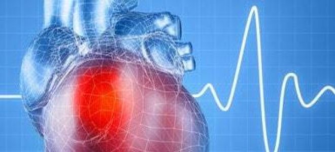 Миграция водителя ритма: что это такое, причины и симптомы, лечение и последствия