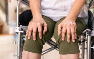 Что такое гонартроз коленных суставов — лечение, симптомы, причины заболевания