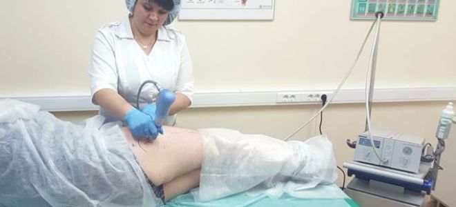 Что такое коксартроз тазобедренного сустава и как его лечить, симптомы, полное описание заболевания