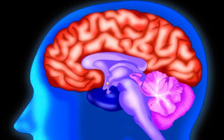 Липома межполушарной щели головного мозга, мозолистого тела, Фалькса: симптомы и лечение