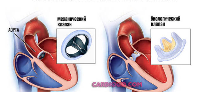 Пульсовое давление: норма по возрасту, причины высокого и низкого ПД