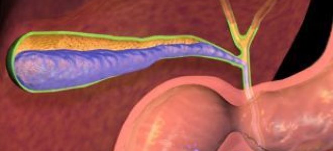 Холангит: симптомы и причины возникновения болезни, механизм развития патологии, инструментальные методы исследования и лабораторные анализы, лечение препаратами и профилактики заболевания, прогноз для жизни