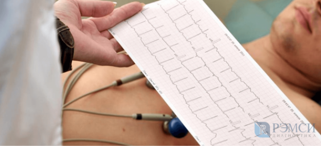 Как болит сердце у женщин: симптомы, признаки болезни