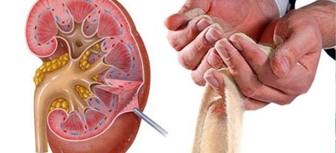 Как очистить почки в домашних условиях