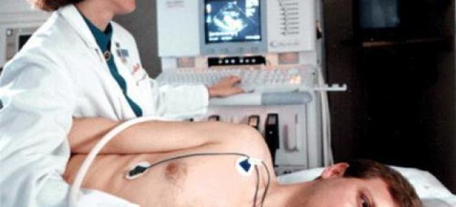 Сердечные аритмии: как развиваются, формы, симптомы, диагностика, лечение, последствия