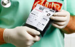 Переливание крови (гемотрансфузия): цели и показания, разновидности, процедура, последствия