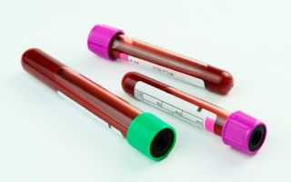 Норма гематокрита в крови: что означает повышение или снижение показателя