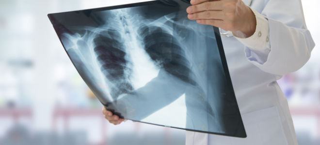 Разрыв аорты: причины и развитие, симптомы, как избежать смерти, операция, прогноз