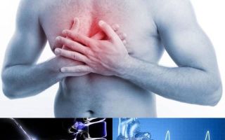 Грудной остеохондроз симптомы: ощущение боль в сердце