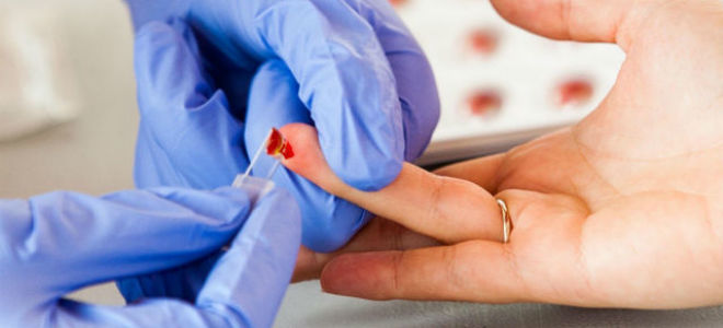 Коагулограмма: что это за анализ, норма и расшифровка показателей