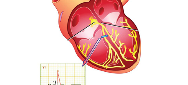 Блокада левой ножки пучка Гиса полная и неполная: причины, симптомы и можно ли ее вылечить