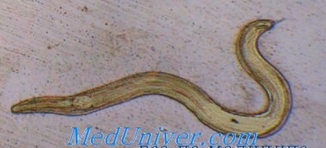 Enterobius vermicularis характеристики, морфология, жизненный цикл, инфекция