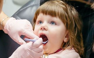 Коренные зубы у детей: сроки и порядок прорезывания постоянных зубов — таблица и схема, симптомы