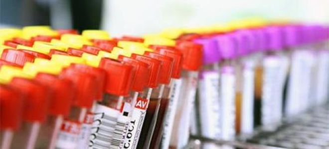 Биохимический анализ крови: нормы у взрослых и детей, показатели, как расшифровать результаты