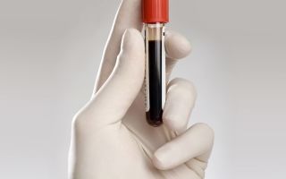 Что это такое pdw в анализе крови: индекс распределения тромбоцитов повышен, норма у женщин