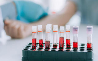 Общий анализ крови: норма и расшифровка результатов (таблица)