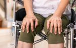 Гонартроз коленного сустава 2 степени: лечение, причины и симптомы заболевания, диета