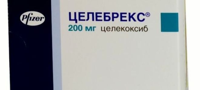 Самая лучшая мазь для суставов колена: какую выбрать от боли в коленных суставах