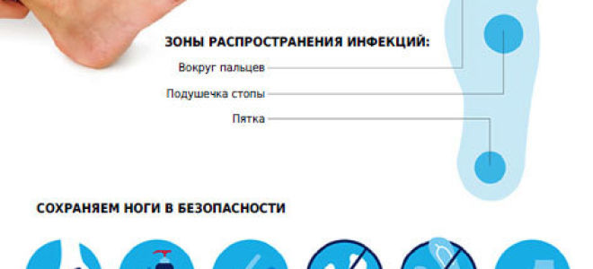 Гангрена при сахарном диабете: лечение, признаки диабетической гангрены