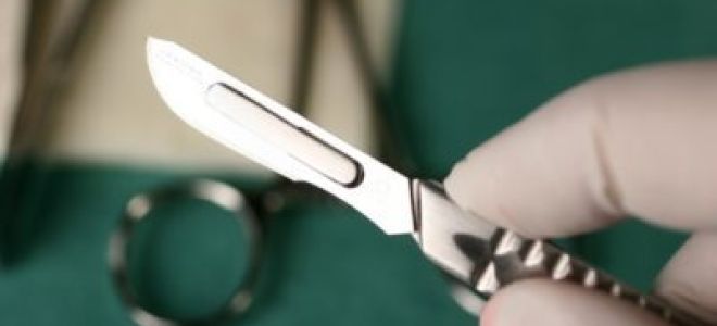 Гинекомастия у мужчин: что это такое и основные симптомы болезни, последствия и осложнения, современные методы лечения и профилактики заболевания