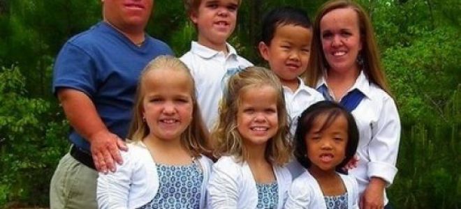 Ахондроплазия у детей: признаки и симптомы наследственного заболевания, стандарты лечения и классификации болезни, комментарии специалистов