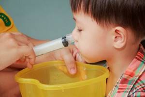 Синусит у детей и взрослых: симптомы и лечение