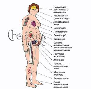 Первые симптомы аутоиммунного гепатита, диагностика и схема лечения заболевания