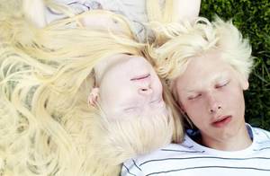 Альбинизм у человека: причины и признаки заболевания, возможные осложнения и профилактические меры