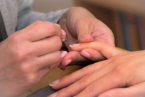 Как избавиться от заусенцев на пальцах в домашних условиях: народные методы, профилактические процедуры