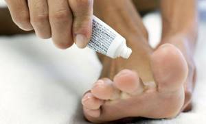 Препараты для лечения грибка ногтей: состав и действие популярных средств, рейтинг самых эффективных и недорогих мазей и лаков для лечения микоза