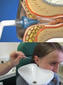 Можно ли промывать уши ирригатором sonic зубная щетка toothbrush