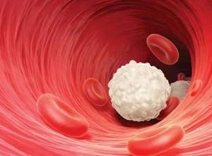 Почему лейкоциты в крови повышены: причины нарушения, сопутствующие симптомы, методы приведения к уровню нормы