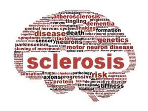 Рассеянный склероз: причины возникновения, характерные проявления, сроки жизни и методы лечения