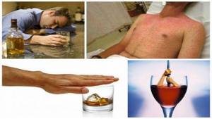 Как проявляется аллергия на алкоголь: признаки и причины непереносимости спиртного, опасности и последствия для организма