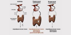 Гипертиреоз щитовидной железы: симптомы патологии, побочные явления и терапевтическое воздействие на болезнь