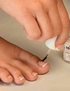 Препараты для лечения грибка ногтей: состав и действие популярных средств, рейтинг самых эффективных и недорогих мазей и лаков для лечения микоза