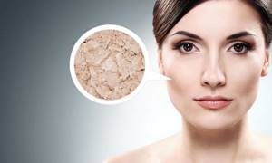 Как лечить купероз на лице: косметологические процедуры, препараты и народные рецепты, советы по уходу