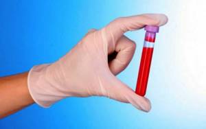 Лейкоциты в крови у женщин: стандарты нормы, возможные изменения, виды обследований, проведение анализа