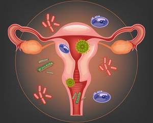 Симптомы гарднереллеза у женщин: основные показания к назначению лечения и способы профилактики заболевания, отзывы пациентов