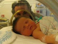 Галактоземия: симптомы у новорожденных, лечение заболевания при помощи медикаментов, осложнения и последствия болезни