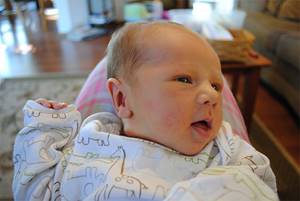 Кефалогематома на голове у новорожденного: причины появления, симптомы и диагностика, методы лечения
