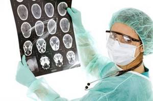 Менингиома головного мозга: классификация и локализация опухоли, клинические проявления, диагностика и способы лечения