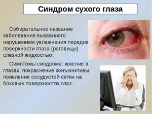 Синдром сухого глаза: причины проблемы, лечение аптечными и народными средствами, профилактические меры