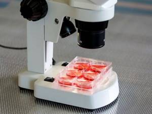 Норма лейкоцитов в крови у детей: уровень содержания, нюансы исследований, подготовка и процесс проведения анализа