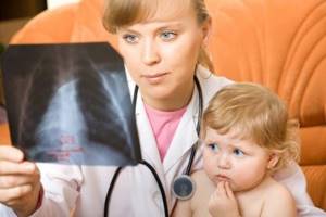 Симптомы и лечение пневмонии у детей и взрослых