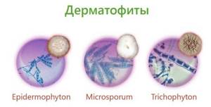 Микроспория у человека: факторы риска заражения, стадии развития и клинические проявления, методы лечения