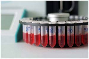Лейкоциты в крови у женщин: стандарты нормы, возможные изменения, виды обследований, проведение анализа