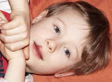 Герпес у детей у взрослых: причины, симптомы и лечение