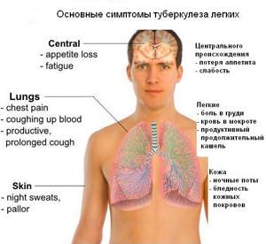 Туберкулез легких: причины недуга, разновидности болезни и характерные симптомы, методы лечения и правила питания