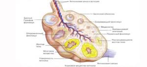 Киста желтого тела яичника: провоцирующие факторы, характерные признаки и методы лечения
